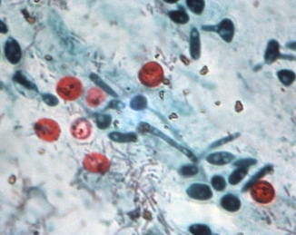 Cryptosporidium spp.